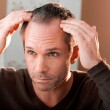 Haarausfall bei Männern: Ursachen, Maßnahmen und Lösungen